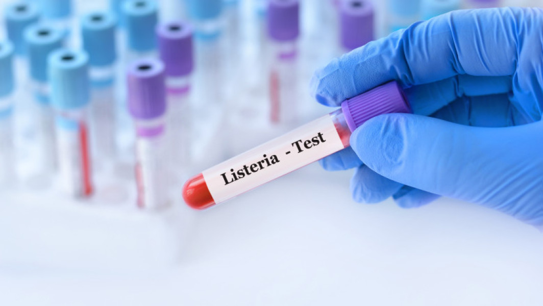 Infecția cu Listeria: Pericole, simptome și măsuri de prevenire